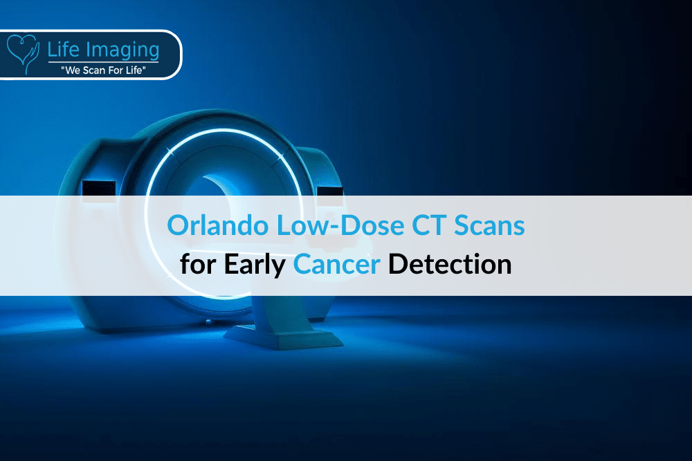 Orlando Low-Dose CT Scans for Early Cancer Detection
